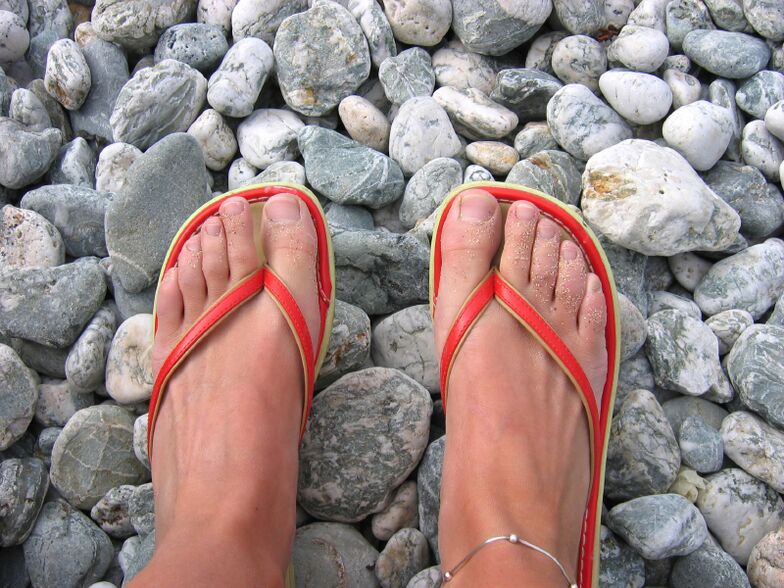 walk on the beach in shoes to prevent fungal infections