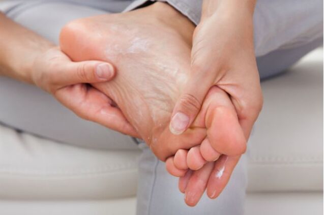 Antifungal creams and drops help in the early stages of toenail fungus