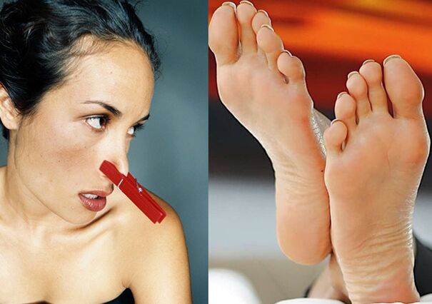 An unpleasant smell of legs