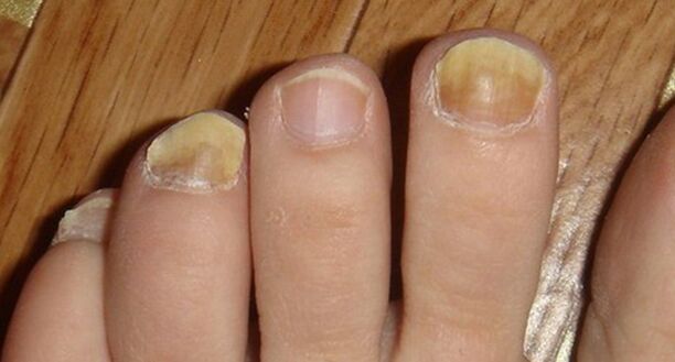 Change the color and structure of the nails