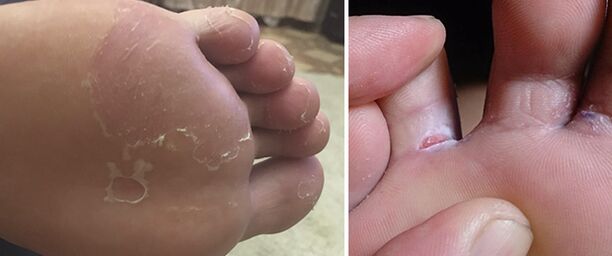 finger