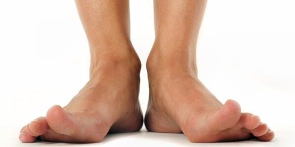 Fungus on feet