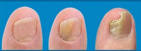 Mushroom development process