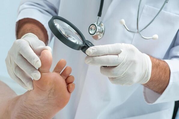 Causes and treatment of fungus on toenails