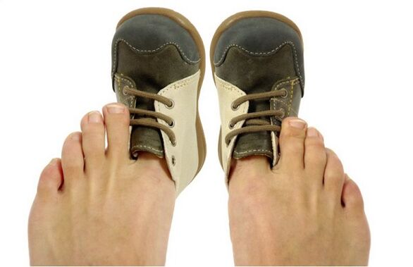 How to recognize toenail fungus by the symptoms